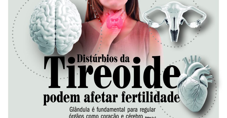PAG1